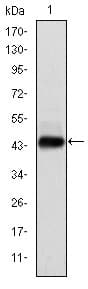 Monoclonal Mouse anti-Human HPV11 E7 Antibody (clone 6F3, IHC, WB)