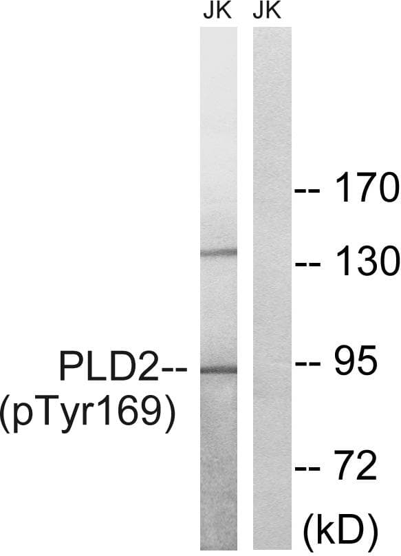 PLD2 / Phospholipase D2 Antibody (phospho-Tyr169)