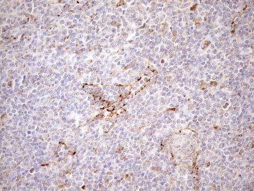 Monoclonal Mouse anti-Human KCTD9 Antibody (clone OTI2G8, aa1-223, IHC, WB)