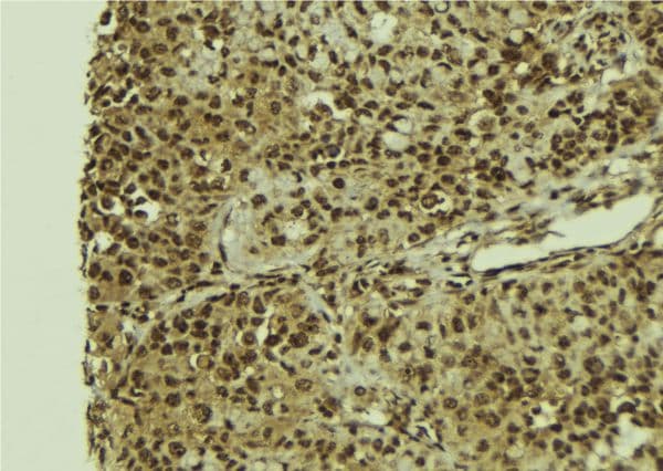 TIP49 / RUVBL1 Antibody
