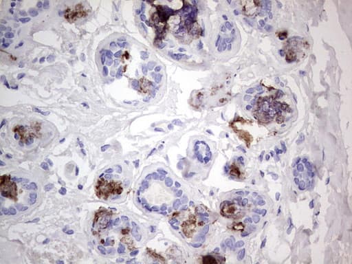 ACE2 / ACE-2 Antibody (aa18-237, clone OTI1D6)