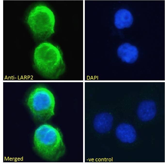 LARP1B Antibody (aa553-566)