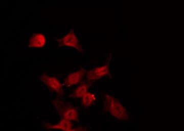 SGK1 / SGK Antibody (phospho-Ser422)
