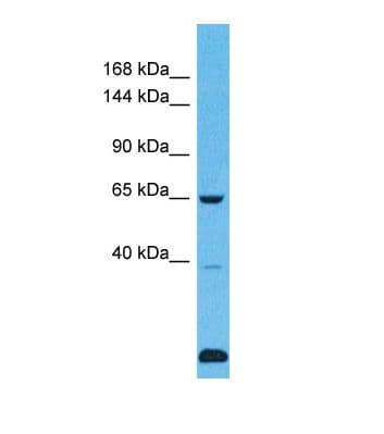 Polyclonal Rabbit anti-Human USP43 Antibody (aa476-525, WB)