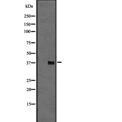 Polyclonal Rabbit anti-Human GPR6 Antibody (WB)