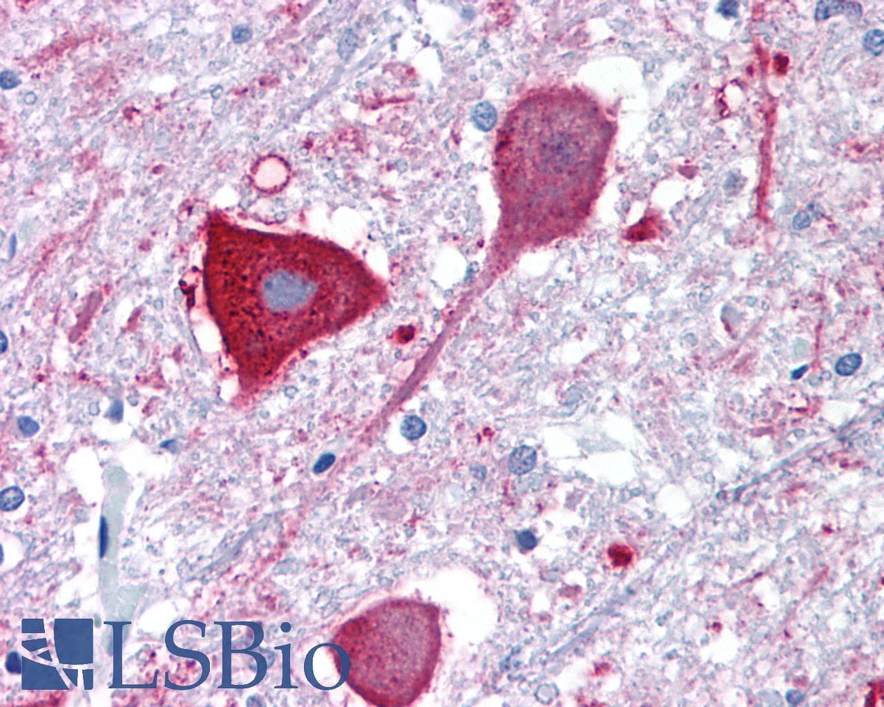 PathPlus™ MRGD / MRGPRD Antibody (Extracellular Domain)