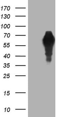 Alpha-Fetoprotein Antibody (aa19-397, clone OTI2F11, Carrier-free)
