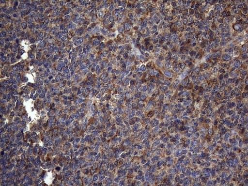 NCR2 / NKP44 Antibody (aa44-190, clone OTI4B8, Carrier-free)
