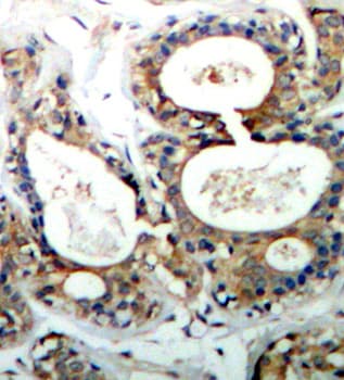 Polyclonal Rabbit anti-Human PTPN11 / SHP-2 / NS1 Antibody (phospho-Tyr542, IHC, WB)