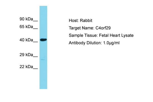 Polyclonal Rabbit anti-Human C4orf29 Antibody (aa122-171, WB)