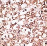 ABCB11 / BSEP Antibody (aa1038-1067)