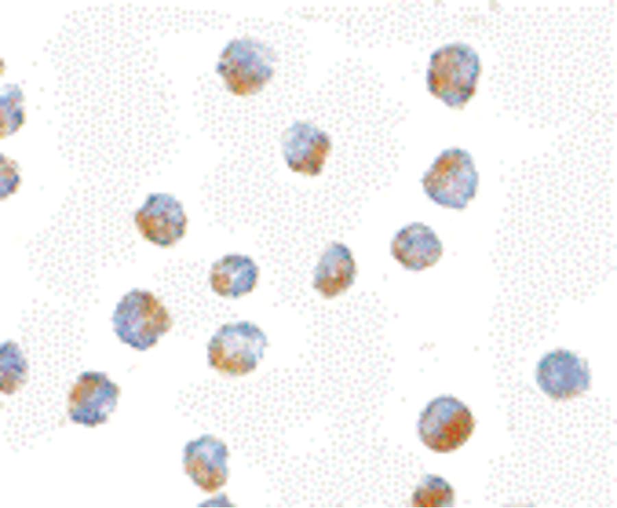 IHC-plus™ Polyclonal Rabbit anti-Human BUB1 Antibody (IHC, IF, WB)