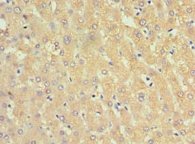 Alpha-1-Antichymotrypsin Antibody (aa24-423)