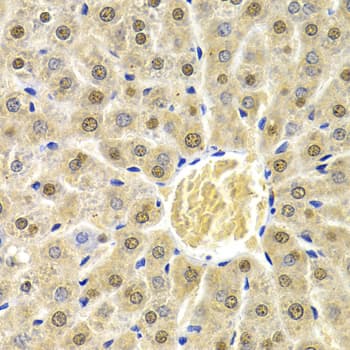 Polyclonal Rabbit anti-Human RAD9A / RAD9 Antibody (IHC, IF, WB)