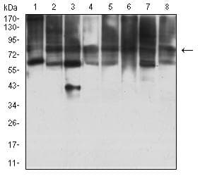 Monoclonal Mouse anti-Human MYST2 / HBO1 Antibody (clone 1D9H9, IHC, WB)