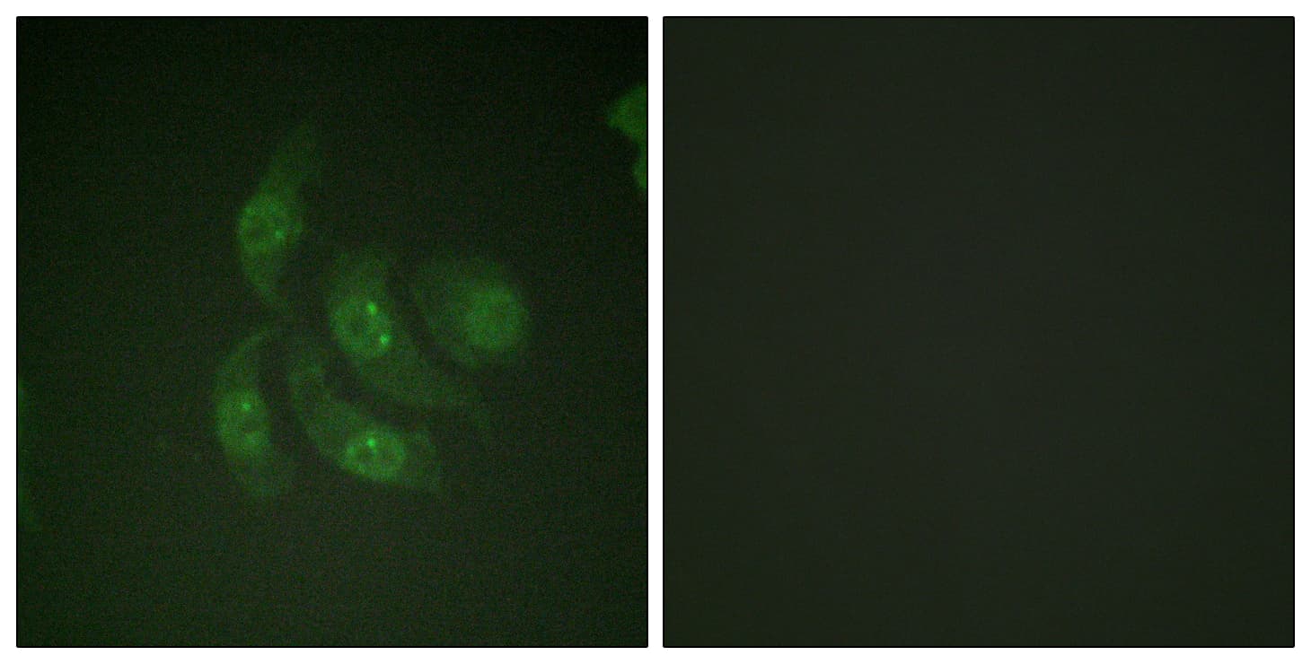 IHC-plus™ Polyclonal Rabbit anti-Human CAMK4 / CaMK IV Antibody (aa166-215, IHC, IF, WB)