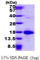 Human LSM4 Protein (Recombinant His)