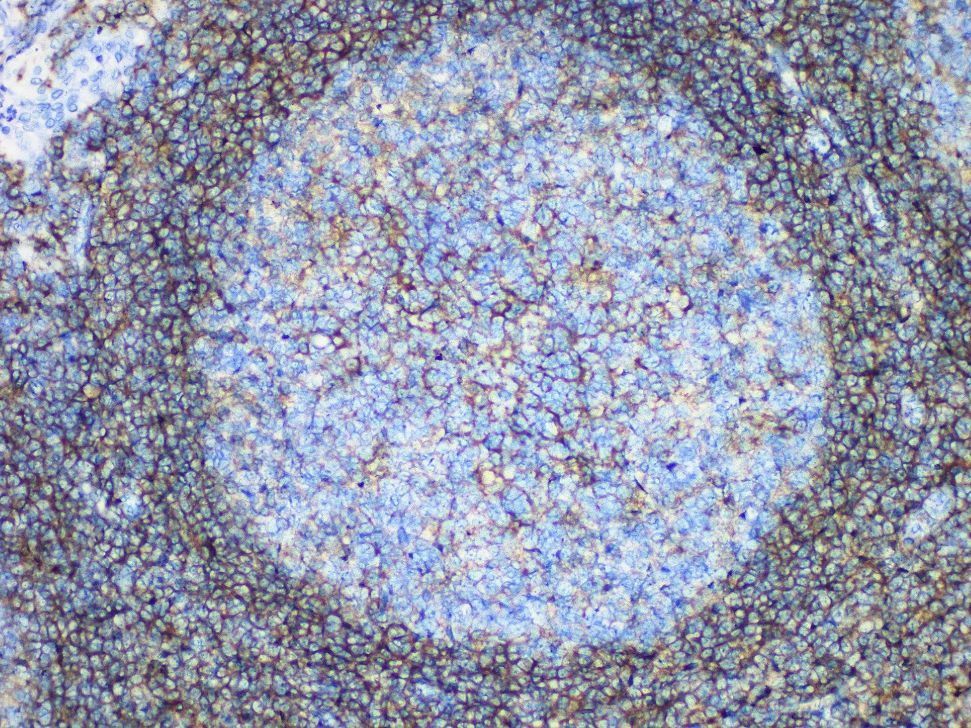 CD44 Antibody