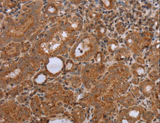 NDUFS2 Antibody