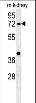 KLHL6 Antibody (aa543-571)
