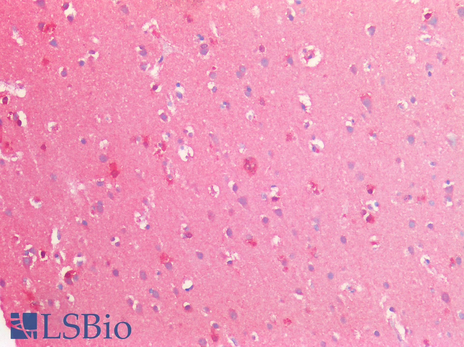 PathPlus™ Monoclonal Mouse anti-Human GLUL / Glutamine Synthetase Antibody (clone AT8D7, IHC, IF, WB)