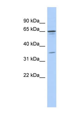 ZNF648 Antibody (N-Terminus)