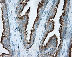 PRKAR2A Antibody (clone OTI1A7, Carrier-free)