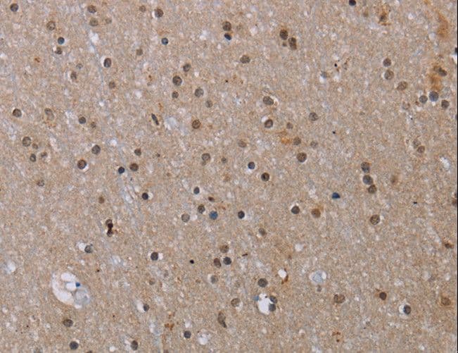 MED12 Antibody