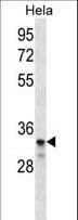 LDLRAD2 Antibody (aa132-160)