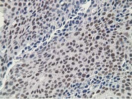 DCK / Deoxycytidine kinase Antibody (clone OTI16G6, Carrier-free)