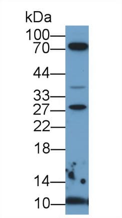 S100A6 / Calcyclin Antibody (aa1-89, APC)