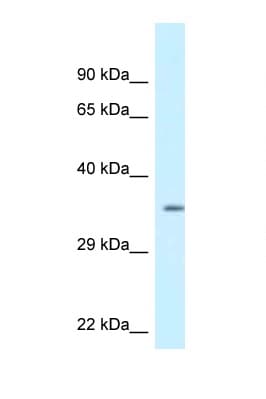 Polyclonal Rabbit anti-Human KCNIP2 / KCHIP2 Antibody (aa204-253, WB)