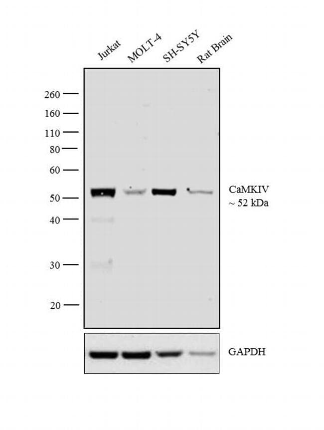 CAMK4 / CaMK IV Antibody (Amino Acid: 35-292, clone 8C5B8)