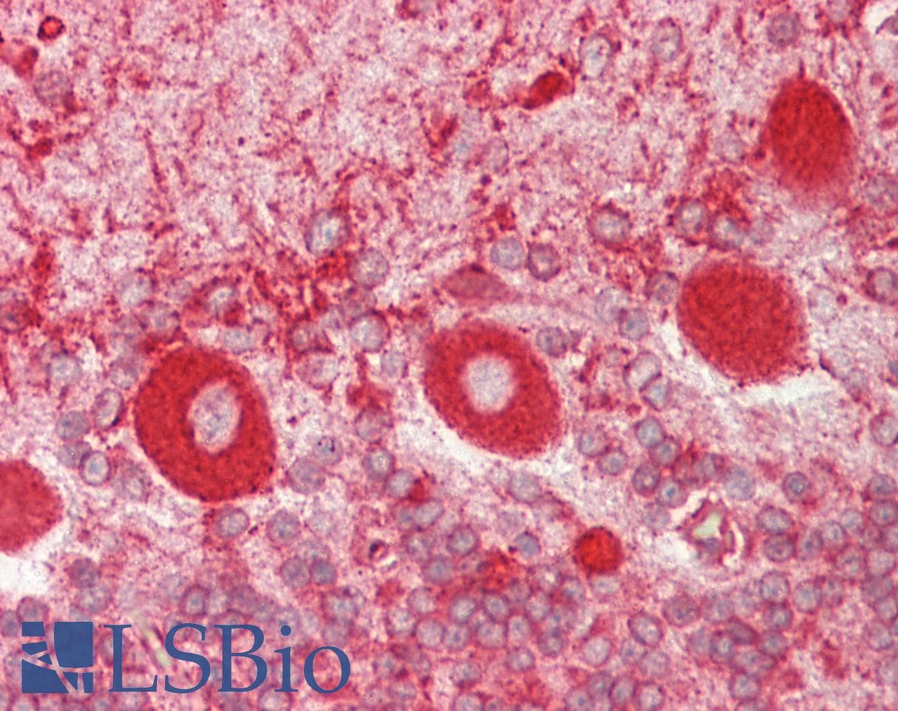 IHC-plus™ CALR / Calreticulin Antibody (aa291-304)