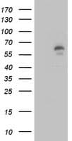 Monoclonal Mouse anti-Human LIPG / Endothelial Lipase Antibody (clone OTI4C10, IHC, WB)