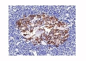 CDw75 Antibody (clone LN1)