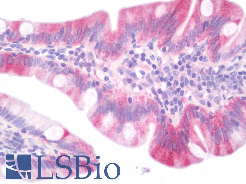 IHC-plus™ DAB1 Antibody (aa191-240)