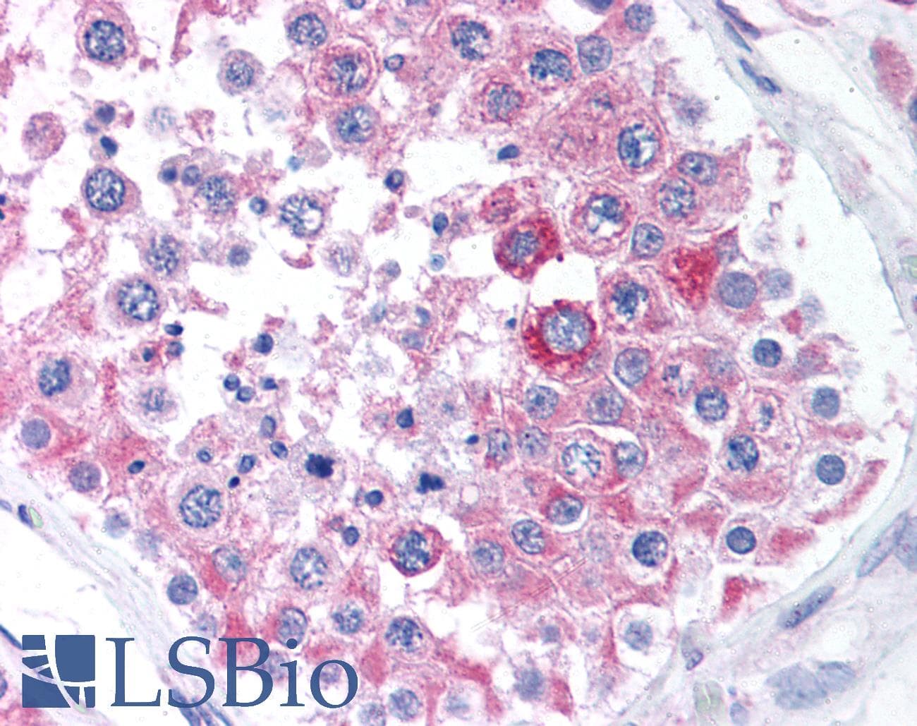 IHC-plus™ BCAP31 / BAP31 Antibody