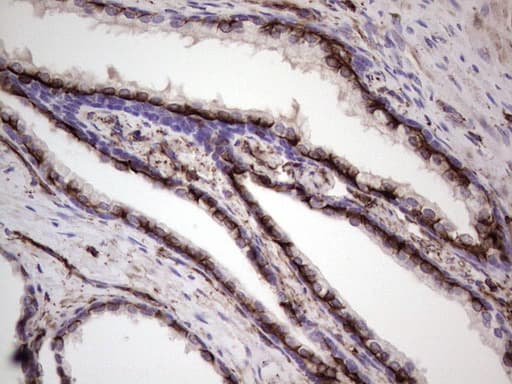 Peripherin Antibody (clone OTI1E10)