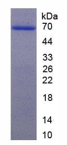 Human CFTR Protein (Recombinant 6His, N-terminus)