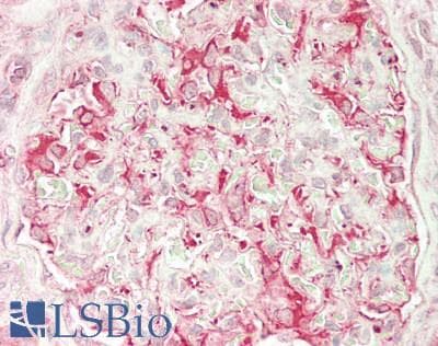 IHC-plus™ ULK3 Antibody (aa445-458)