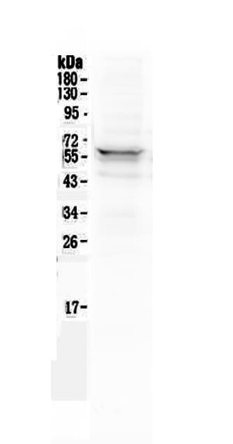 Polyclonal Rabbit anti-Human LYN Antibody (IHC, WB)