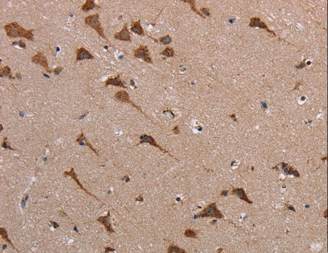 Polyclonal Rabbit anti-Human POMT1 Antibody (IHC)