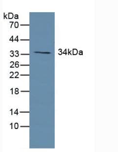 Growth Hormone Receptor / GHR Antibody (aa315-574)