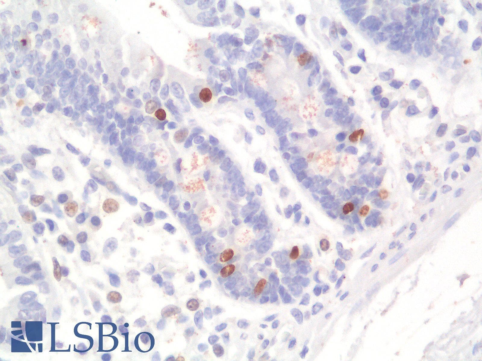 PathPlus™ NKX2-2 Antibody (clone rNX2/294)