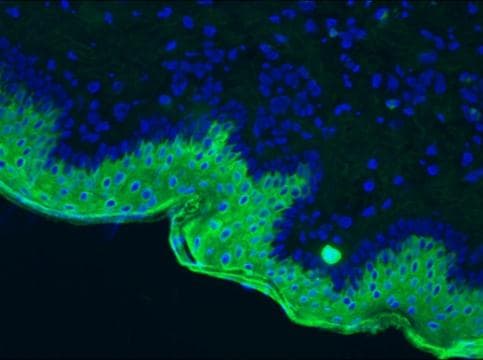 Monoclonal Mouse anti-Human KRT10 / CK10 / Cytokeratin 10 Antibody (clone RKSE60, IHC, WB)