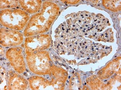Polyclonal Goat anti-Human ADORA2B/Adenosine A2B Receptor Antibody (aa311-321, IHC, IF)