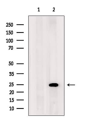 ARL8 / ARL5B Antibody