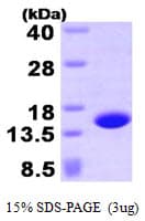 Human PFN4 Protein (Recombinant His)