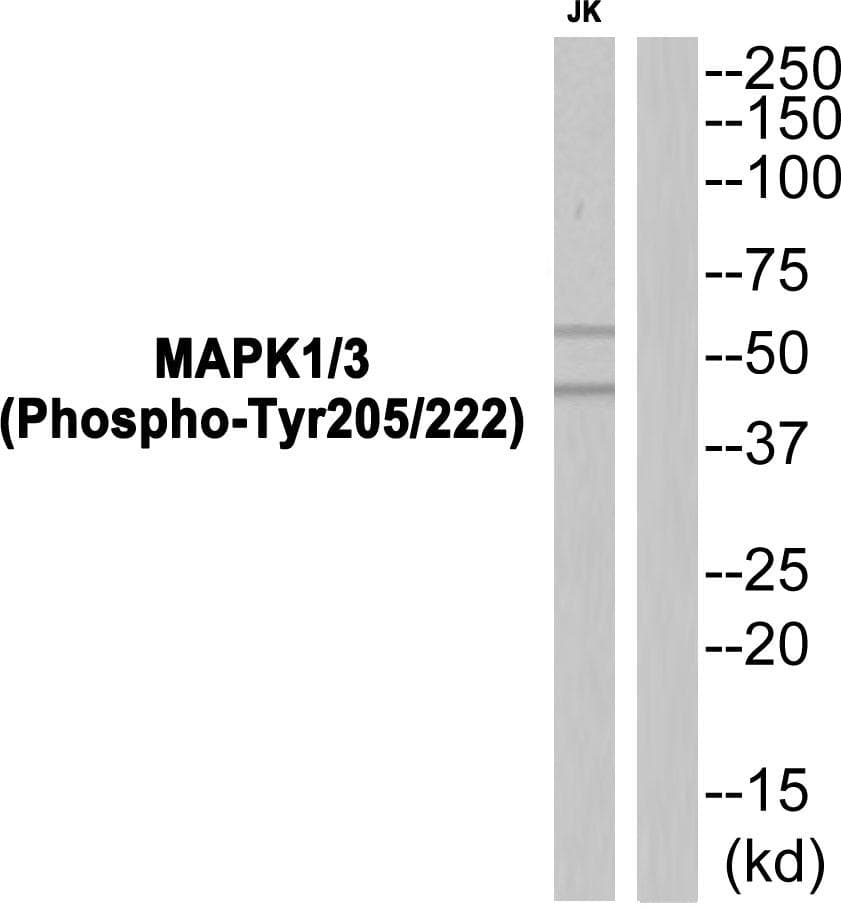 Polyclonal Rabbit anti-Human SYK Antibody (phospho-Tyr352, WB)